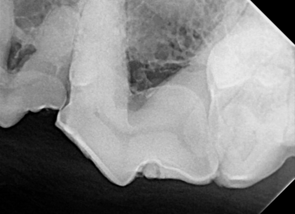 Dental radiograph