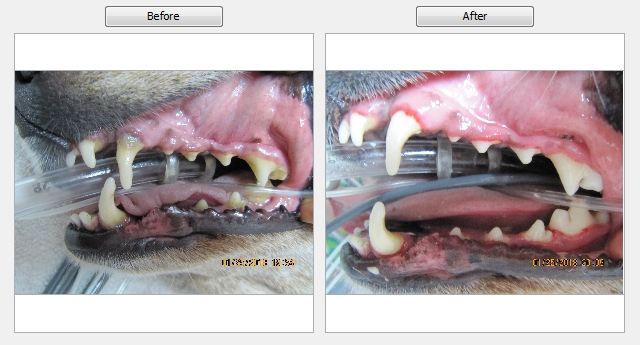 Dental Before & After